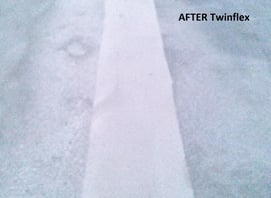 After Twinflex